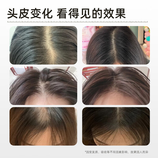 伊千语【伊千语洗发水】防脱控油尹千语洗发膏侧柏叶改善掉发防断发 【洗护装】洗发水+香氛发膜
