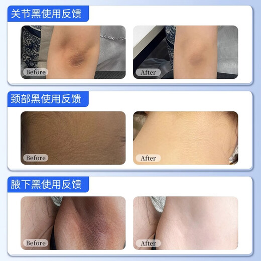 COLOR SUNNY Darkening skin on elbows, removing melanin deposits on knees, finger joints, private parts, armpits, removing dead skin