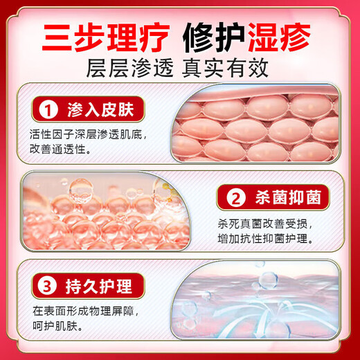 Peking Union Medical College, Japan imported eczema ointment Shiduqing skin itching dermatitis 100% fungal king infection to remove itching root special effect one box of ointment eczema itching package elimination stubborn eczema heat rash skin ringworm baby antibacterial anti-itching ointment