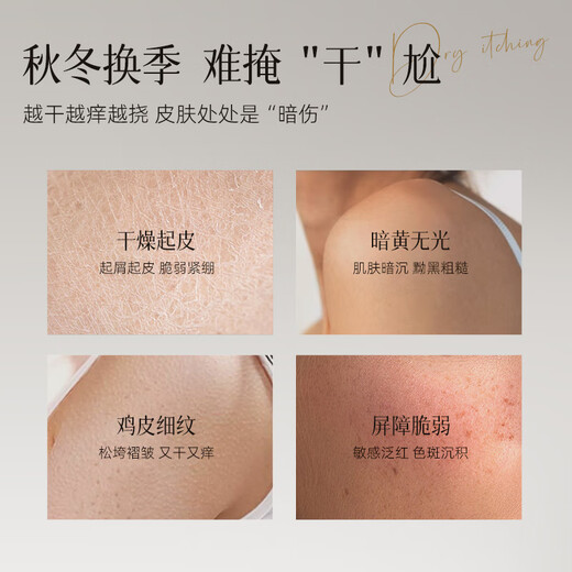 Allowish imported 377 whitening body lotion 250g brightening, moisturizing, rejuvenating, anti-itching lotion, autumn and winter fragrance, long-lasting for men and women