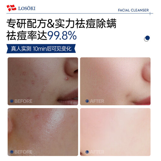 Losoki Swiss imported amino acid facial cleanser, whitening, oil control, acne removal, mite removal, blackhead removal, special facial cleanser for men and women