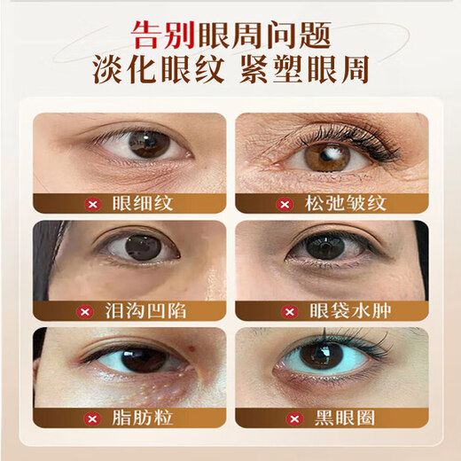 Baishu Astragalus Augencreme verdünnt feine Linien dunkle Ringe Augenbeutel Anti-Falten-Straffung Feuchtigkeitsfeuchtigkeitsfeuchtigkeitsfeuchtigkeitsfeuchter Entfernung Hautpflegeprodukte 2 Packs 40g