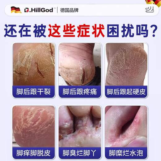 Dr.HillGod's athlete's foot, itching, peeling, rotten feet, fungal infection, itchy, sweaty feet, special medicine for cracked feet, dry and cracked heels, two boxes with special effects