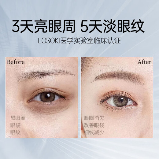 SOOKI Swiss Imported Eye Cream Light Line Line Lines Tripts Custers Dark Circles Удаляет мешки с глазными мешками против морщин и антивозрастных продуктов по уходу за кожей подарки