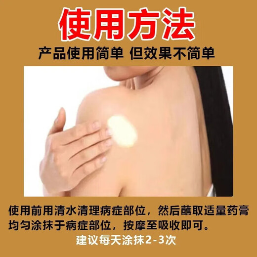 Mupirocin ointment, sebaceous cyst ointment, can be used to see the face, remove subcutaneous acne, powdery tumor hyperplasia, redness, inflammation, boils, poisonous pimples, pustules, anti-inflammation, treat pustules, poisonous boils, 2 boxes of red pimples and swelling on the body