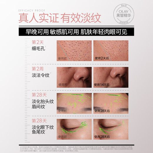 Olay (OLAY) light lines black tube essence 50ml anti-wrinkle firming anti-aging facial essence Christmas gift for girlfriend Bailu