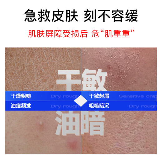 Sakose Vaseline Herren B5 Feuchtigkeitsorisierende und beruhigende Creme 80G Feuchtigkeitsfeuchtigkeits-Ölkontrolle Rötung Anti-Crack Trockenhautpflegeprodukte