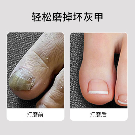 Suquan Electric Nail Grinder, Onychomycosis Trimmer, Nail Grinder, Removes Dead Skin, Gray and Thick Nails, Multifunctional Grinding Head Combination Pack