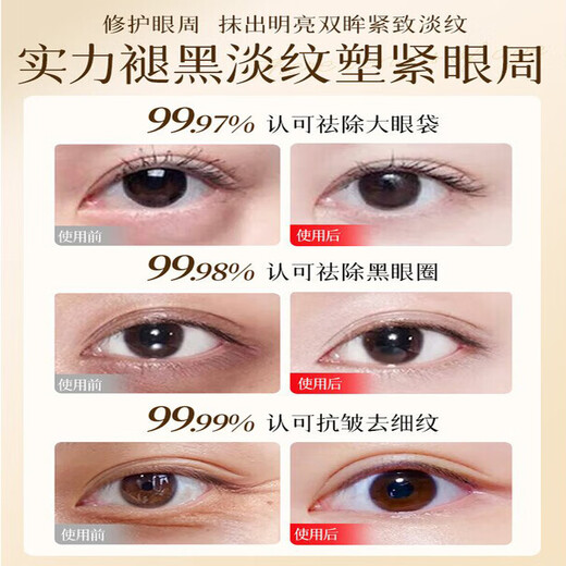 同仁堂眼霜淡化细纹提拉紧致眼周去除黑眼圈眼袋消除脂肪粒抗皱严重眼袋 买2送1【针对严重眼袋】