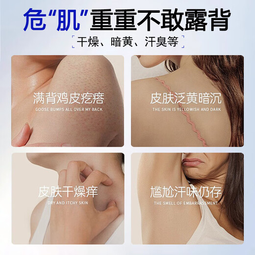 SEEDONVEUR 20% Urea Cream Body Lotion Moisturizing Anti-dry Cracked Black Goose Pimple Moisturizer for Men and Women 500g