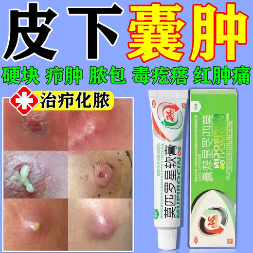 Mupirocin ointment, sebaceous cyst ointment, can be used to see the face, remove subcutaneous acne, powdery tumor hyperplasia, redness, inflammation, boils, poisonous pimples, pustules, anti-inflammation, treat pustules, poisonous boils, 2 boxes of red pimples and swelling on the body