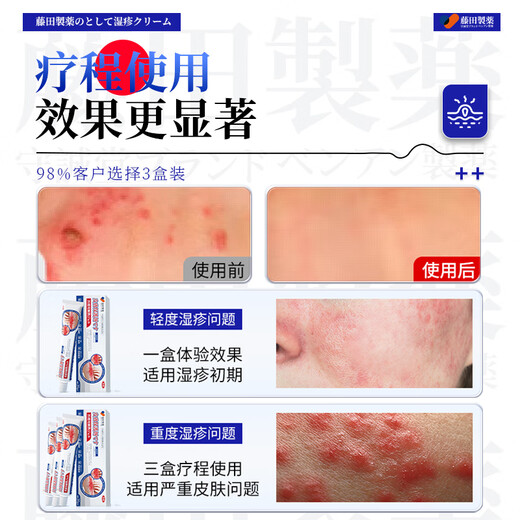Fujita Pharmaceutical Eczema Ointment Anti-itching Skin Itching Dermatitis Eczema Fungal Infection Sweat Herpes Anal Itching 1 Box