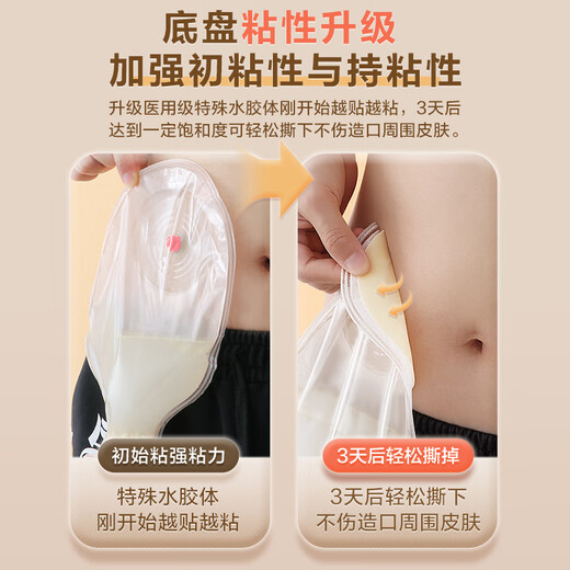 可孚肛肠一件式造口袋大便肠癌改道一次性瘘粪开口袋 5009-1盒]基础夹子款+3个夹子