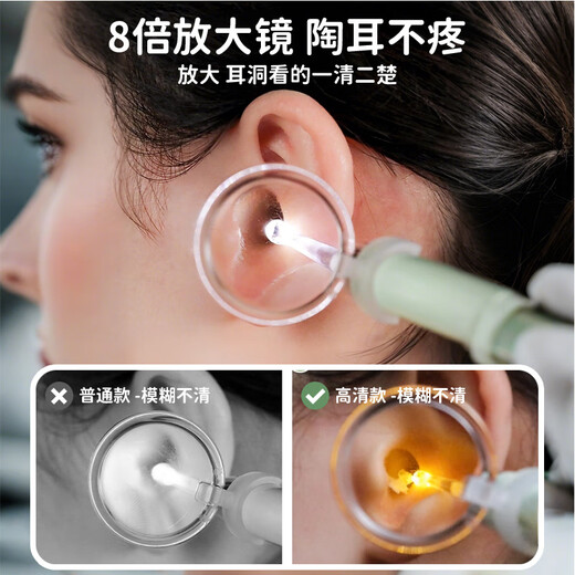 Page Mom Children's Ear Spoon Ceramic Ear Artifact Baby Glowing Ear Spoon Newborn Visible Ear Picking Single-piece Set