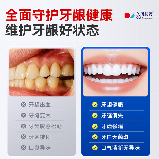 Hisaoka Pharmaceutical Medical Periodontitis Gingivitis Special Toothpaste for Bleeding and Swelling Pain 120g Hisaoka Pharmaceutical Medical Periodontitis Gingivitis Special Toothpaste for Bleeding and Swelling Pain 120g