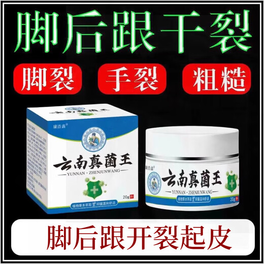 Yunnan Fungus King's Official Flagship Authentic Dry and Cracked Heels, Rough, Self-Starting, Hard Skin, Hand Openings, Dry and Cracked Anti-Cracking Cream, One Box, It Is Recommended to Take Multiple Bottles