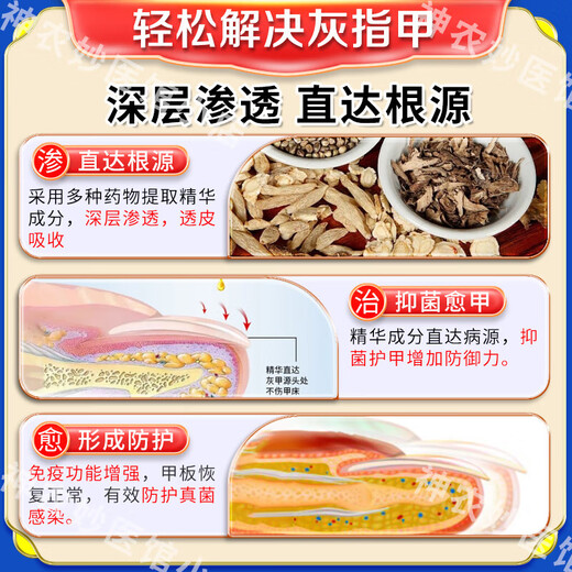 Akita Zeren's special medicine for onychomycosis, special nail fungus infection removal, bad nail brightening, root treatment, original imported from Japan, special effect, today's special offer, shoot 1 for 3, JD.com, what medicine is good for onychomycosis, fast, special ointment for onychomycosis room