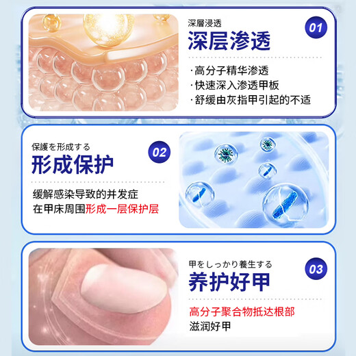 Bujiugang's special plaster for non-severe onychomycosis, nail fungal infection, non-imported onychomycosis, impatiens antibacterial liquid, onychomycosis liquid, newly upgraded, official authentic Japanese special effect onychomycosis liquid 1 box (mildly applicable)