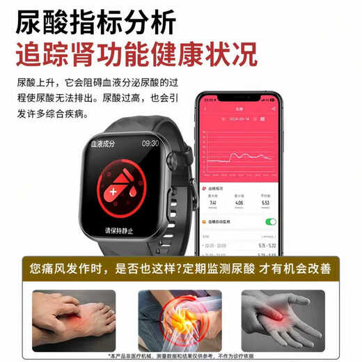 FUKR Huawei machine is suitable for high-precision non-invasive blood sugar and blood pressure monitoring watch to measure blood lipid uric acid blood oxygen heart rate dynamic needle-free instrument intelligent health all-in-one machine sports bracelet noble black [non-invasive blood sugar and blood pressure monitoring + NFC access control offline payment]