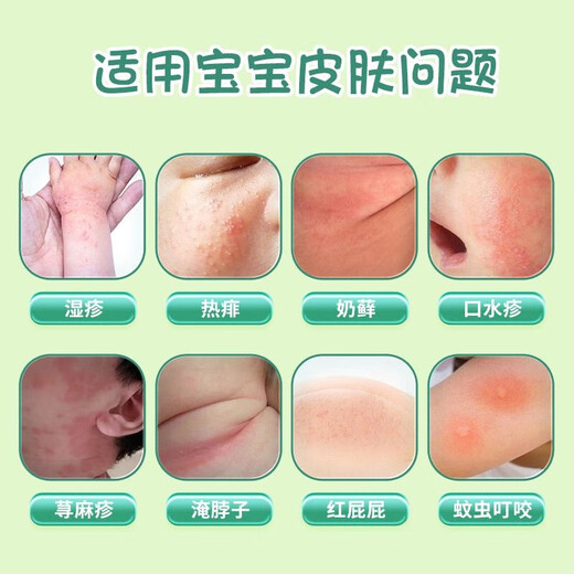 TXRMDX calamine antibacterial and antipruritic cream plant extract double protective cream baby soothing ointment Shi Runfu baby special eczema heat rash
