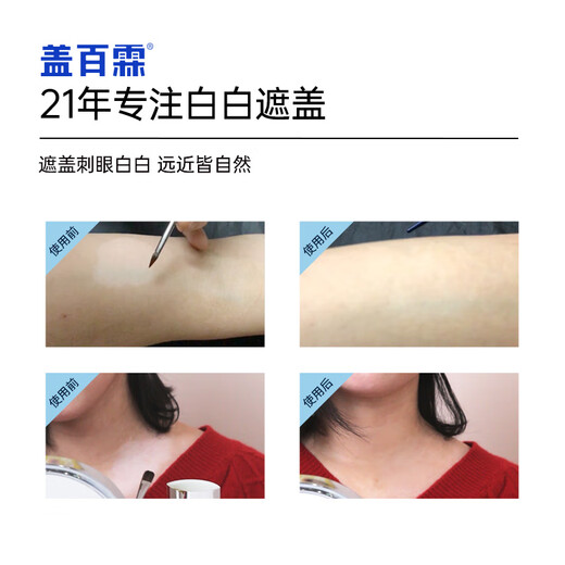 Gai Bailin Vitiligo Covering Liquid White Spot Covering Liquid Instant Covering Pen Plus Black