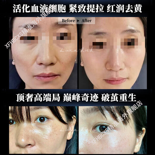 XFHBCXS [Recommandé par Hu Bing] L'âge du premier plat hyperactivité des cellules liquides du monde Max Double Cabin Murffon est un mystère. Les 5 cycles complets de Great King sont de 16 868 yuans.