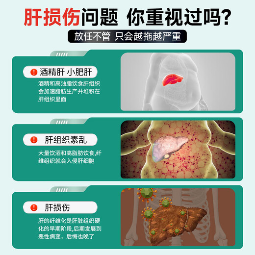 Yangzhisu Yunnan Baiyao Liver Huantian Tablet Yangzhisu Sushu Gan Tablets Liuxuan Liver Health Liver Social Drinking Stay up late to detoxify and reduce aminotransferase 3 bottles of powerful packaging [Consolidation and strengthening, say goodbye to liver problems]