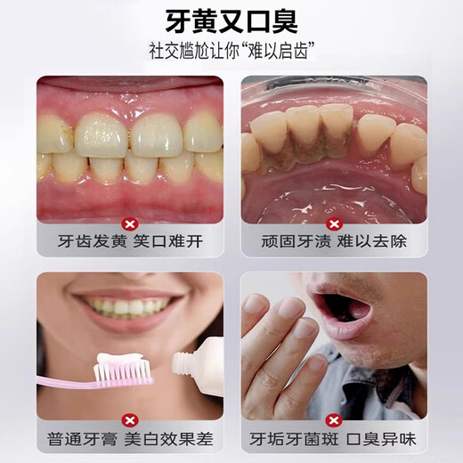 Drvialy Whitening Zahnpasta-Geruch und vergilbte Zahnflecken Entfernen Sie Zahnflecken Top-zehn bekannte Marken von Tartaren Fluor-haltigen Zahnfärben, die Zahnpasta aufhellen [zwei Packungen] Langzeitpflege nimmt hartnäckige Zahnpasta ab