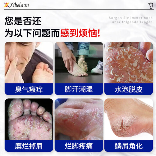 XIBELAON German wolfsbane athlete's foot spray to relieve itching, peeling, rotten feet, fungal infection, blisters, itchy feet, sweating, foot odor, medicinal root