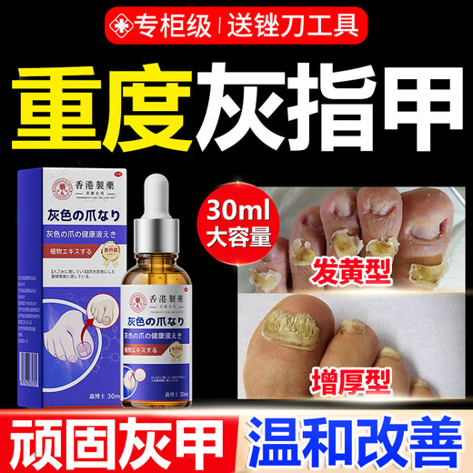 Dr. Xin's onychomycosis special effect specializes in treating nail infection with yellowing and thickening root cream 30ml.