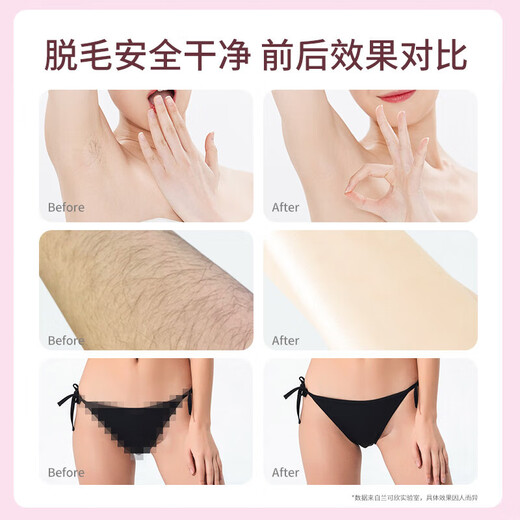 Xiaomi Baby Electric Shaver Private Parts Trimmer Armpit Hair Portable Men and Women Special Shaver Hair Removal Device Pussy Hair Remover Ivory White - Comfortable No Black Spots Left + IPX6 Waterproof