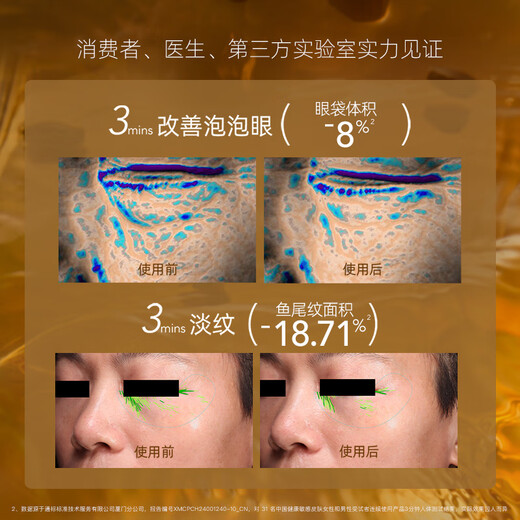 阿芙（AFU）董洁推荐权杖眼油按摩仪11籽眼部精华油淡纹紧致眼霜送礼物 眼油10ml+精华水乳240ml直播专属