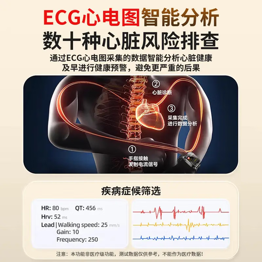 AELVO Huawei machine Hongmeng system Apple machine IOS suitable for precise air bag air pump blood pressure smart monitoring watch heart rate blood oxygen blood sugar uric acid blood lipid health recording instrument