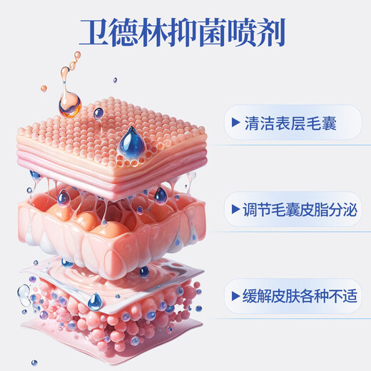 Wedelin Antibacterial Liquid Single Pack Whole Body Skin Hair Follicle External Antibacterial Spray Brand Genuine Look for Wedelin Antibacterial Liquid 30% Customers Choose 1 Bottle