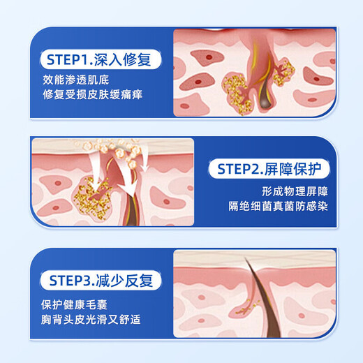 Gukanlin arm folliculitis red blood acne improves skin and scalp red rash pustules Get 2 boxes with discount