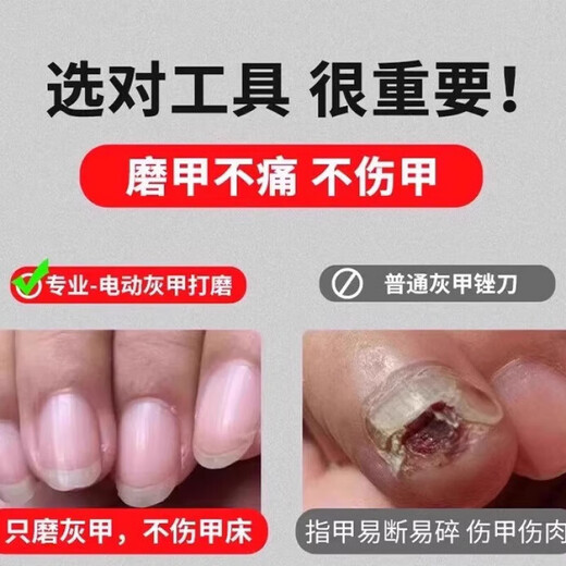 Mi Hong German electric nail clipper fully automatic hand and foot dual-use original nail polisher old man thick polisher gray trimming toenail white nail polisher shot 1 shot 6 4-speed adjustment to enhance horsepower