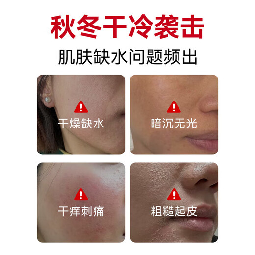 Chuman Facial Niacinamide Vitamin E Skin Care Glycerin Hydrating, Moisturizing, Anti-Aging, Faltenstraffung und Aufhellung Liquid Essence Facial Skin Care Malaysian Glycerin 140ML Großes Produkt Meistverkaufte Skin Care Glycerin TOP-Liste Nr. 1