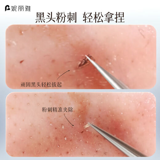 Nilia Superfine Glue No. 5 Cell Clip Blackhead Clip Tweezers Beauty Salon Special Closed Pimple Scratching Needle Tool Sharp Mouth Cell Clip 1 Piece Free Gift