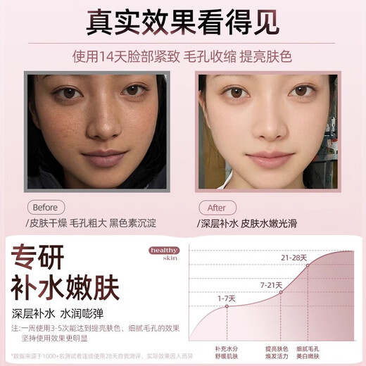 Xia Xin facial steamer, hot spray facial steamer, humidifying and hydrating artifact, nano sprayer, household facial beauty instrument, hydrating, opening pores, detoxifying and fumigating, gift for ladies, exclusive version - elegant powder, negative ion oxygen generating large mist + can add fruits and vegetables