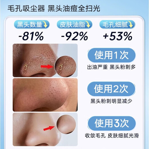 Xu Lin, Germany, blackhead suction instrument, super large suction cleaner, electric blackhead suction, acne shrinking pores, household small bubble beauty instrument, acne removal artifact, electric blackhead instrument, new flagship model, free blackhead gift bag