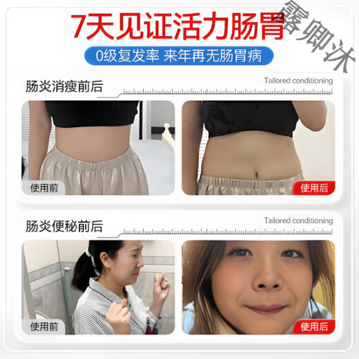 Yinglin Pirenzepine Capsules, Hongsen Pharmaceutical Tablets, Gastrointestinal Patch, Chronic Gastritis, Japanese Gastrointestinal Medicine, Original Import, Body Care, Buy 3, Get 2 Free, Medium to High Gastritis Problem/New Upgrade, Official Direct Sales