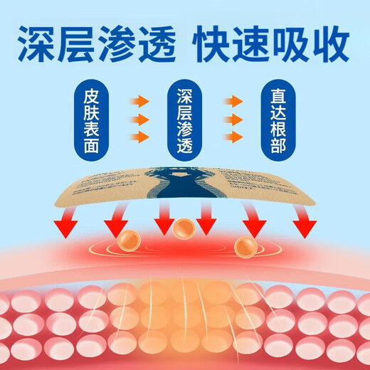 Tramamadol analgesic cancer pain relief sustained-release tablets imported paracetamol hydrochloride late cancer pain relief two boxes of moderate pain