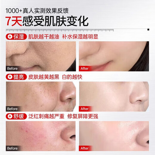 Chuman Facial Niacinamide Vitamin E Skin Care Glycerin Hydrating, Moisturizing, Anti-Aging, Faltenstraffung und Aufhellung Liquid Essence Facial Skin Care Malaysian Glycerin 140ML Großes Produkt Meistverkaufte Skin Care Glycerin TOP-Liste Nr. 1