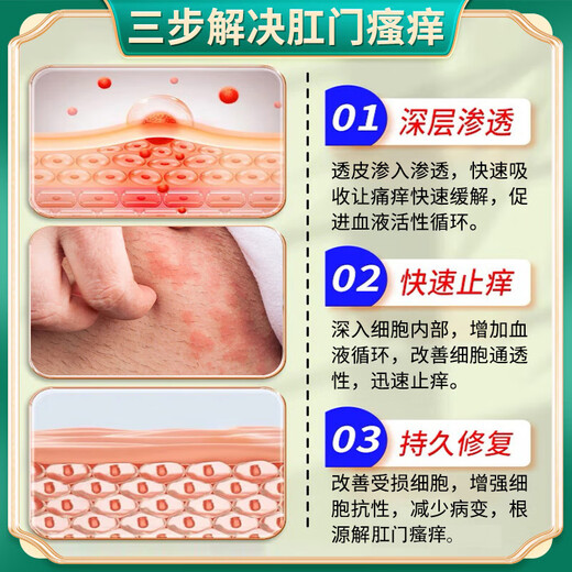 Luo Shenyi anal itching ointment to relieve itching, special perianal eczema moist root removal, sterilization, butt itching, hemorrhoids, itching, fungal infection, 1 box, special anti-itching cream