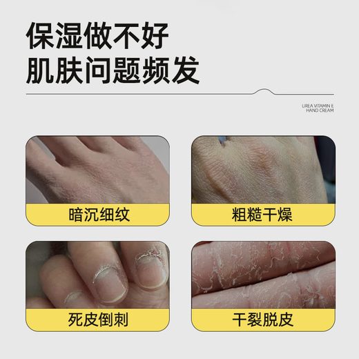 Sakose Vaseline 20% Urea Vitamin E Hand Cream 120g Autumn and Winter Highly Moisturizing, Non-greasy, Anti-Drying, Improves Rough Hands