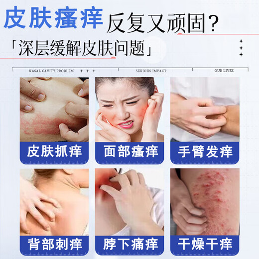 Nippon Chemical 3 seconds to relieve itching, special effect skin anti-itch cream, calamine ointment, antibacterial cream for dry skin, can be used all over the body, 1 bottle trial pack, powerful anti-itching cream