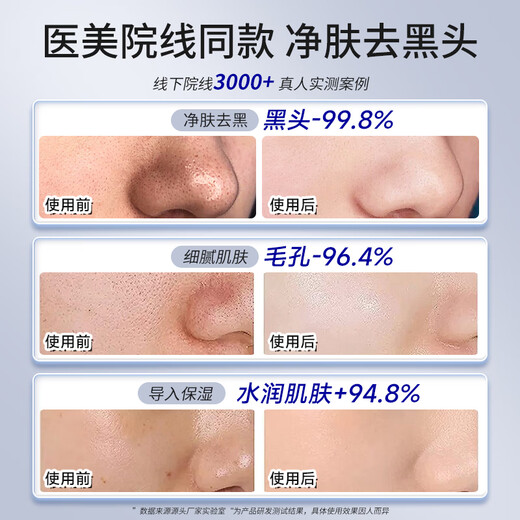 DIKTT Valentine's Day and New Year's gift for girlfriend Blackhead shovel beauty instrument for home use to remove blackheads and acne, beauty salon special facial pore cleaning, tightening, 2025 new flagship model, ultrasonic cleaning + 29000Hz, shrink pores + ion export + blackhead removal