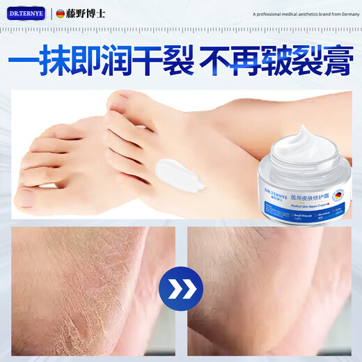 SIENORC Cracked Feet Cream for Cracked Heels, Cracked Heels, Cracked Heels, Cracked Heels, Foot Cream, Foot Cream 1 Box, Stay away from Cracked Hands and Feet on the same day