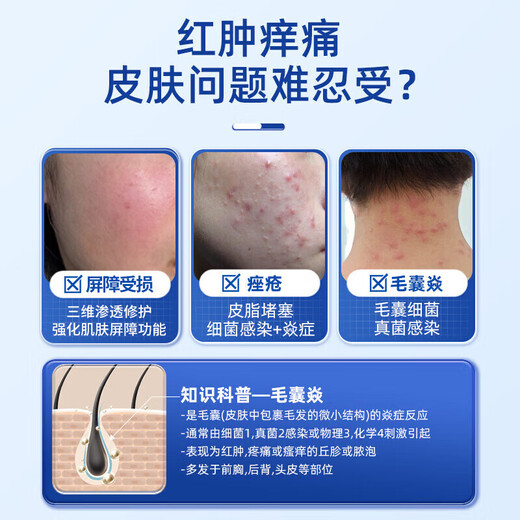 Gukanlin arm folliculitis red blood acne improves skin and scalp red rash pustules Get 2 boxes with discount