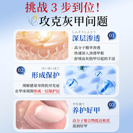 I-medicine for onychomycosis and severe antibacterial liquid. Fungal infection. Onychomycosis thickens, turns yellow, thickens and becomes empty. A box of onychomycosis cream. I-medicine for onychomycosis and onychomycosis. Jingdong Pharmacy